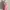 Abercrombie Pink Striped Babydol 