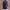 Dark Mori Kei Dress With Outer Set