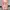 Fairy Babypink Lace Ruffle Kawaii Vintage Rare Coquette Y2k